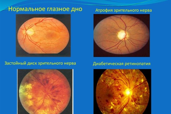 Кракен почему не заходит